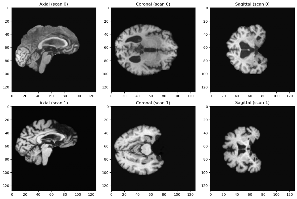 MRI brain scan samples